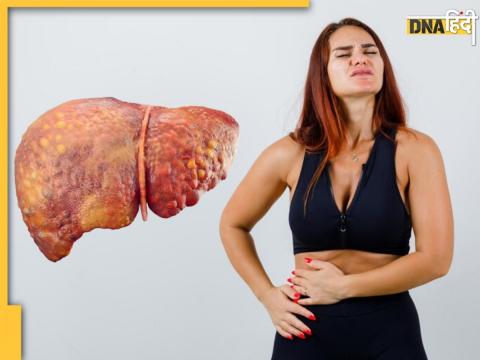 Fatty Liver Remedy