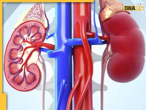 Kidney Detox Tips