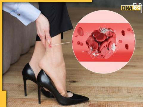 Effects Of Wearing High Heels