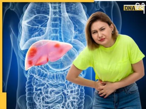 Fatty Liver Remedy