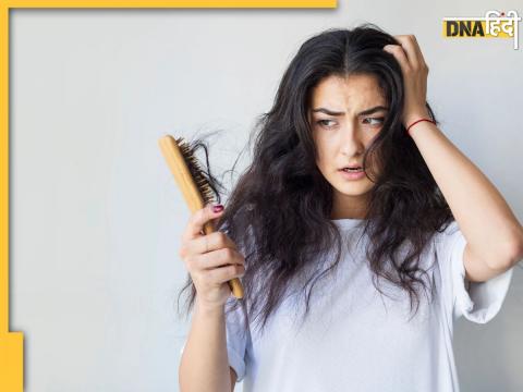 Hair Fall Control Remedies