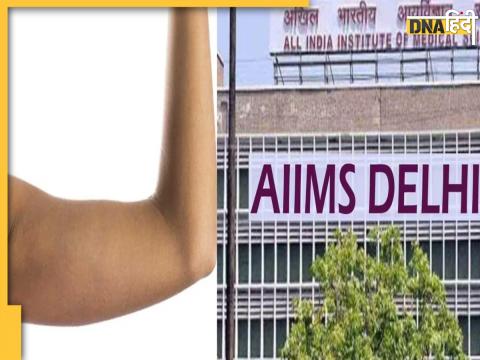 AIIMS Delhi Elbow Replacement 