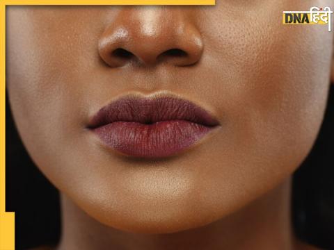 Dark Lips Home Remedies