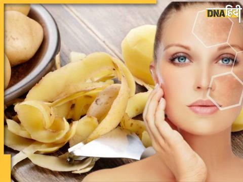 Potato For Remove Pigmentation And Dark Spots