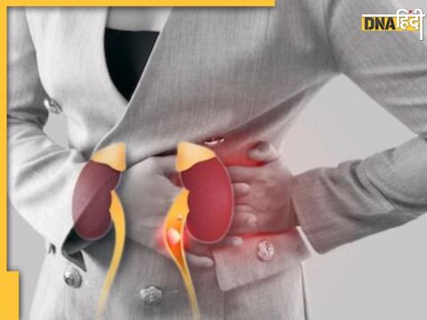 Ayurvedic Herbs for Kidney Stone