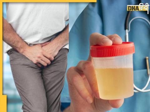 Causes of Foamy Urine