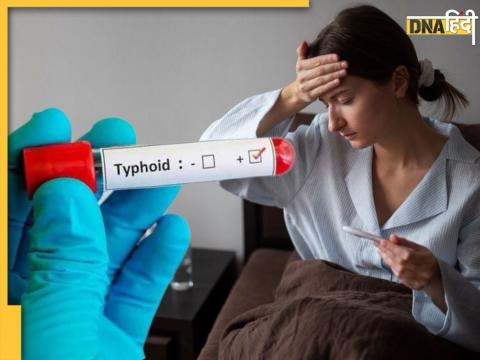 Home Remedies For Typhoid