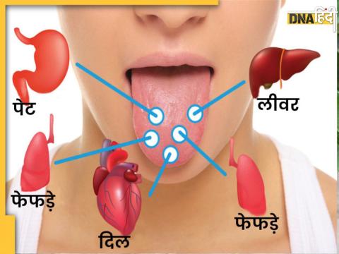 जीभ खोलेगी सेहत का राज