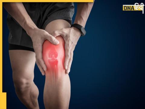 Home Remedies For Arthritis