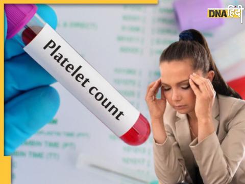 Platelet Count