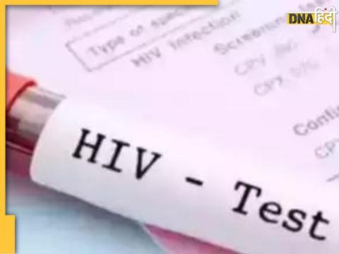 HIV