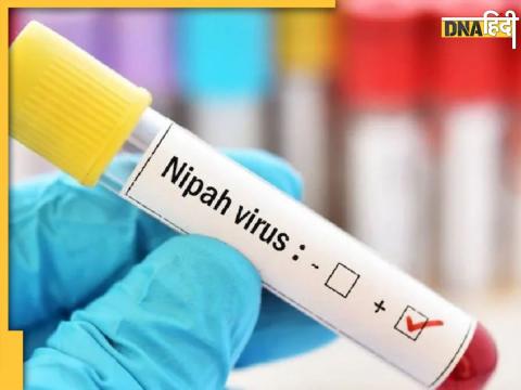 Nipah virus infection