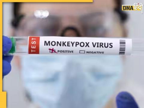 Monkeypox Virus