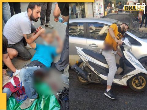 Beirut Serial Blast में जेब में रखे पेजर्स फटने के कारण घायल हुए हिजबुल्लाह से जुड़े लोग.