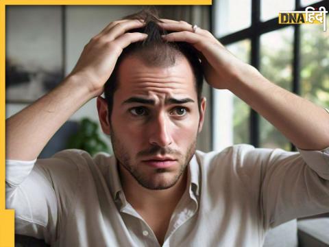 Baldness and Hair Loss