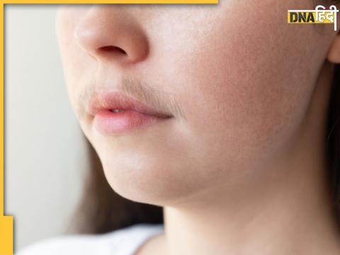 facial hair home remedies 