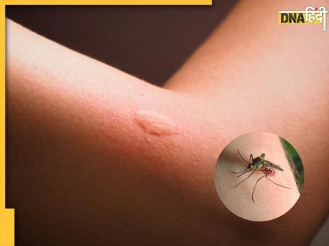 Mosquito Repellent Tips