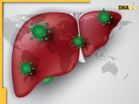 Liver Cancer Causes