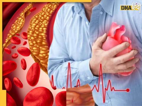 Cholesterol Symptoms