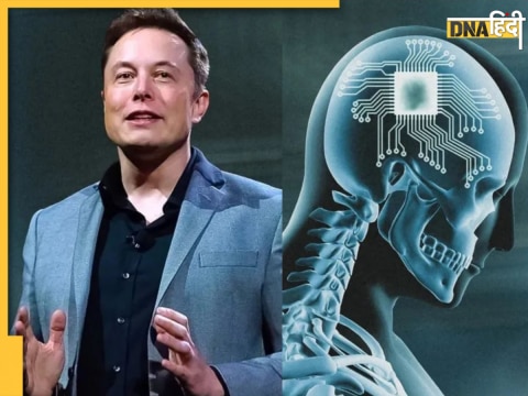 Elon Musk Neuralink Brain Chip