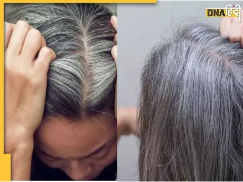 White Hair Remedies White Hair Remedies