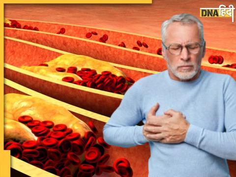 Bad Cholesterol Bad Cholesterol