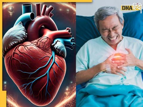 Bad Cholesterol Bad Cholesterol