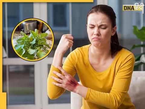 Uric acid remedies Uric acid remedies