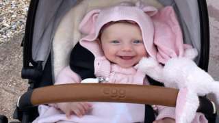 5-month-old baby is 'turning to stone' due to THIS rare condition...
