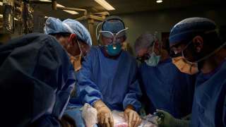 Pig kidney transplanted in human, doctors say functioning 'pretty norm...