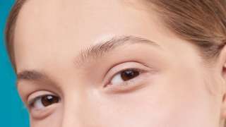 Home remedies: How to make your acne disappear overnight