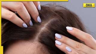 Balding early? Check these 5 foods to promote good hair growth