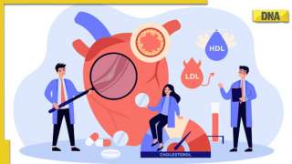 Heart diseases: Check these 5 foods that help you control cholesterol