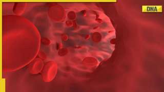 Suffering from anemia? Check these 5 foods to increase your hemoglobin level