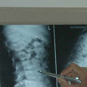 Radiology body condemns AIIMS Director's statement on 'CT Scan causing cancer, calls in irresponsible - Vimarsana News