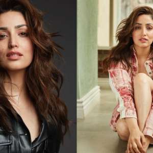 Yami Gautam reveals she suffers from a skin condition, drops unedited pics - Vimarsana News