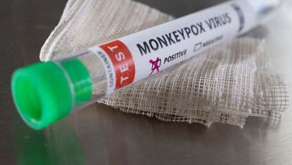 Rajasthan issues advisory for passengers from monkeypox affected countries