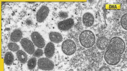 Monkeypox outbreak: UK upgrades disease severity to leprosy, plague level