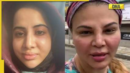 Urfi Javed asks ‘who do I resemble’ as she shares photo with allergies, netizens call her ‘Rakhi Sawant without makeup’