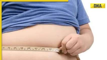 DNA Special: Why obesity is increasing among people globally, know risks of diseases linked with it