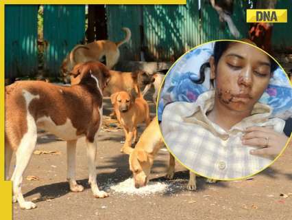 Stray Dog Attack in Kanpur: 21-year-old sustains facial injuries, undergoes 17 stitches after cheek splits into two