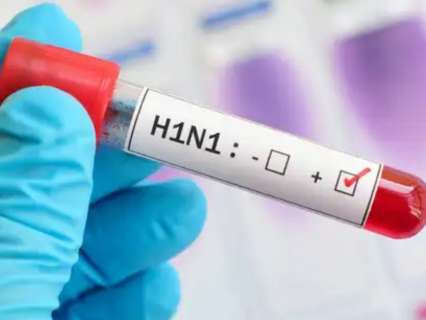 Delhi Reports 1,344 H1N1 Cases: Are you at risk? Know symptoms and prevention