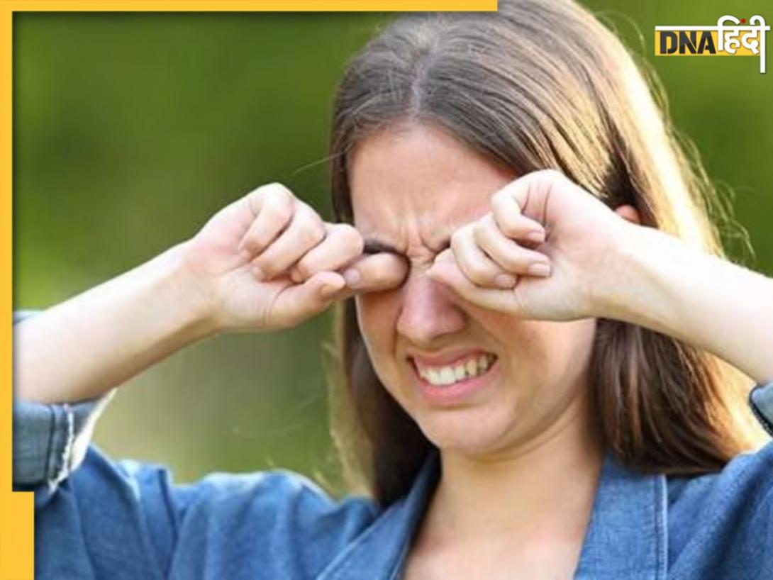 Eye Care: आम नहीं आंखों में जलन-खुजली होना, समय पर नहीं दिया ध्यान तो हो सकती हैं ये गंभीर समस्याएं