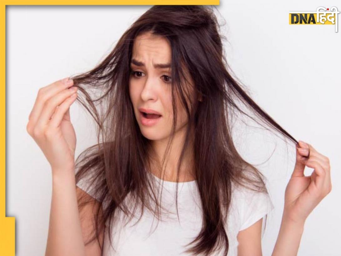 Hair Loss Control: झड़ते बालों की समस्या को और बढ़ा देंगी ये 5 चीजें, दवा का भी नहीं होगा असर