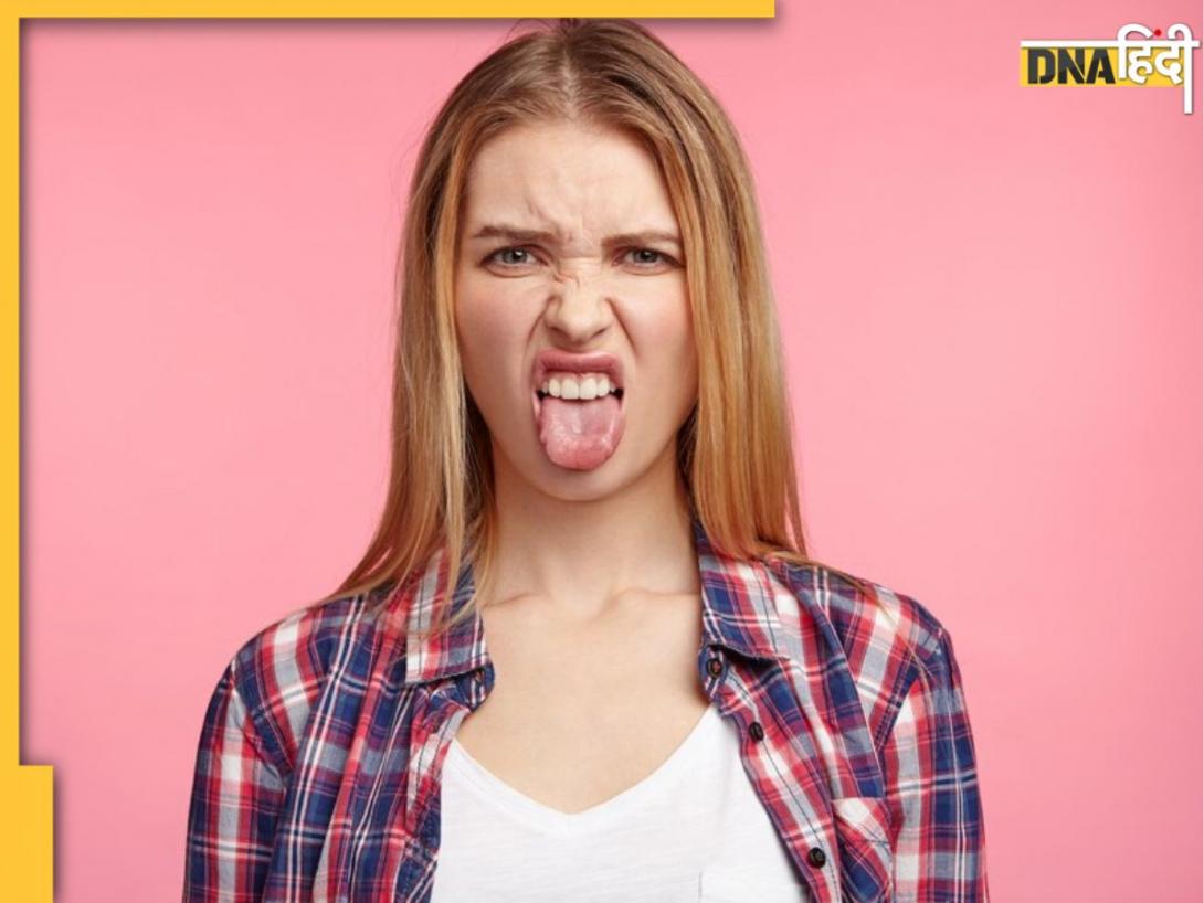 Burned Tongue Remedy: गर्म खाने-पीने से जल जाए जीभ तो अपनाकर देंखे ये घरेलू नुस्खे, जलन और दर्द से मिलेगा आराम