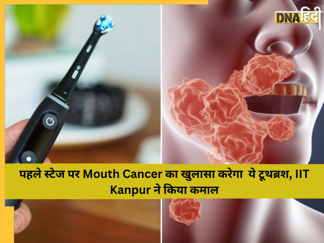 पहले स्टेज पर Mouth Cancer का खुलासा करेगा ये टूथब्रश, IIT Kanpur ने किया कमाल 