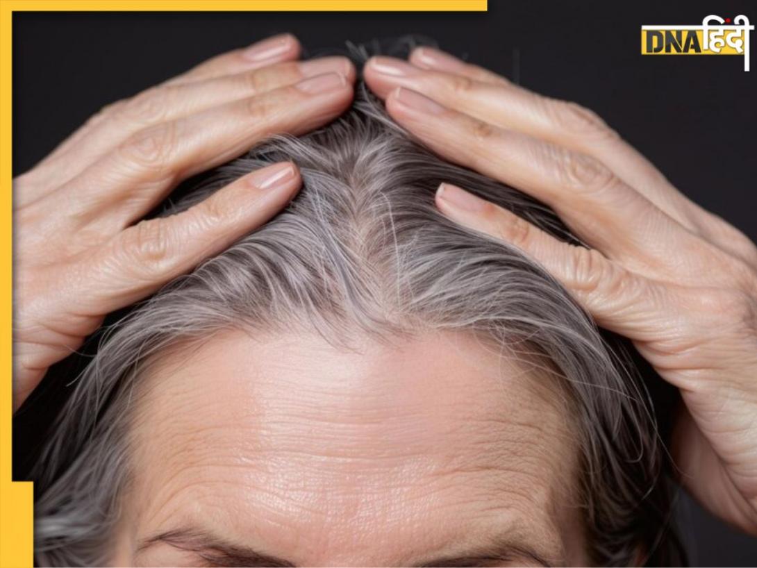White Hair: जवानी में सफेद हो रहे बाल, तो महंगे हेयर कलर छोड़ रसोई में रखी इन 5 चीजों से करें काला