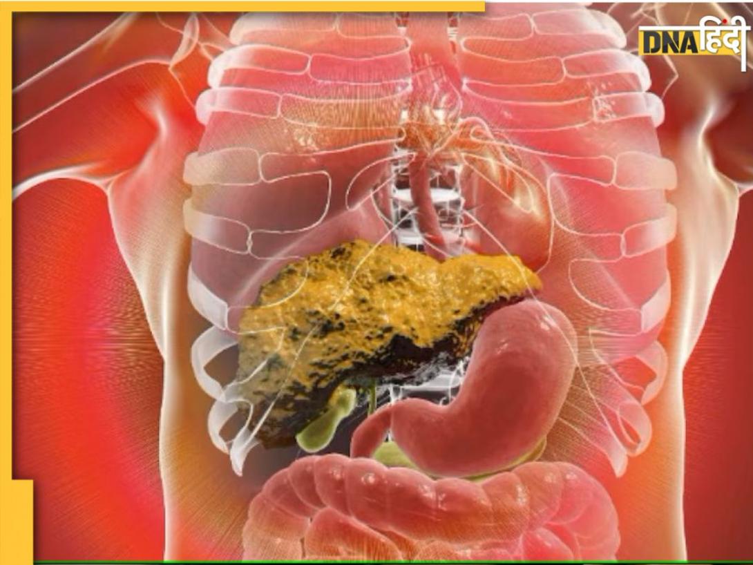 Liver Damage Causes: सुबह की ये गलतियां लिवर को सड़ाती हैं, नहीं दिया ध्यान तो बढ़ जाएगा कोलेस्ट्रॉल और डायबिटीज