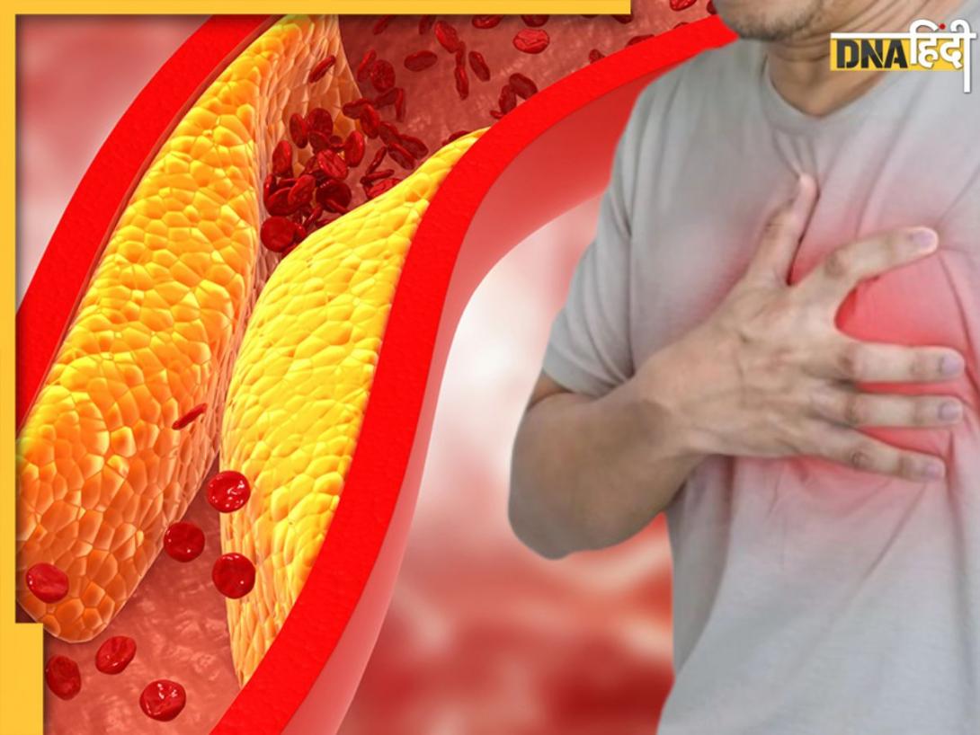 Bad Cholesterol को बाहर निकाल फेंकेगी किचन में मौजूद यह चीज, 5 तरीकों से करें सेवन