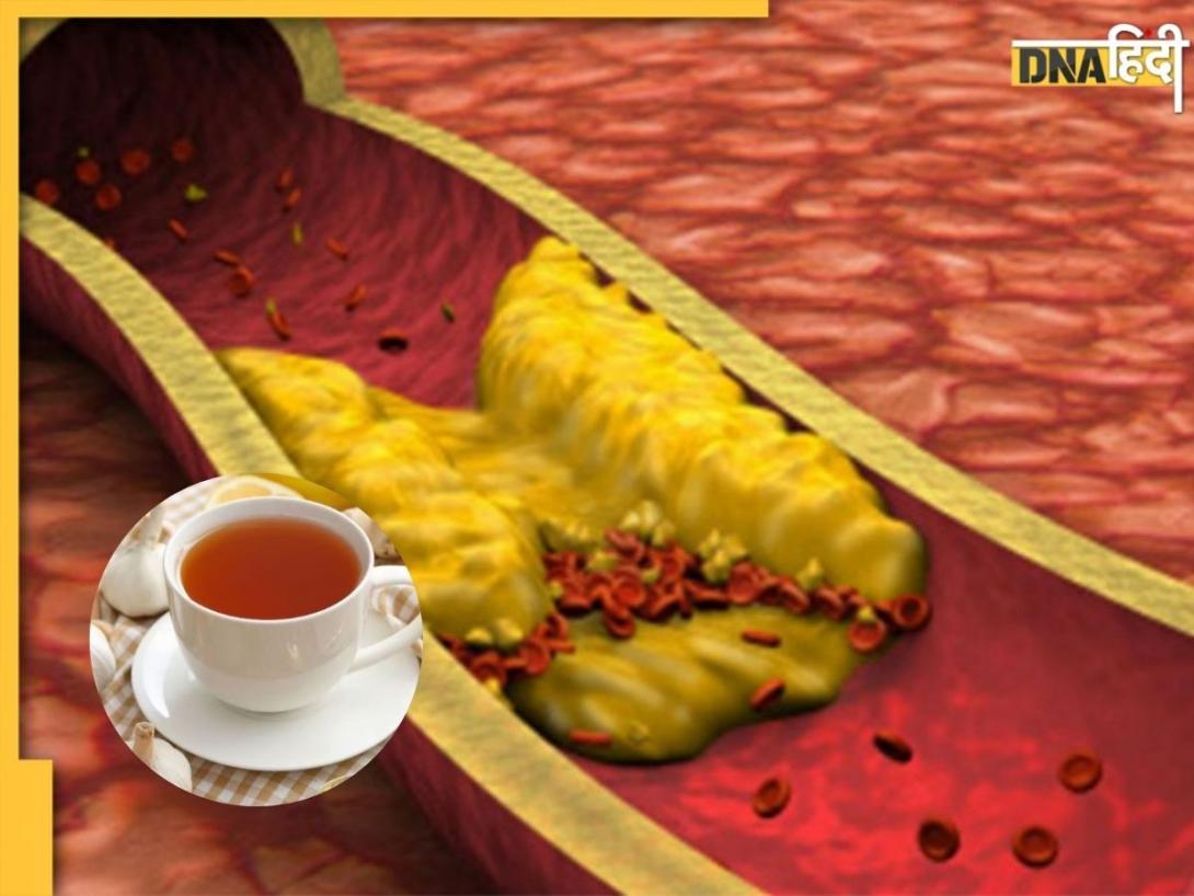 नसों में जमा Bad Cholesterol पिघला देंगी ये 5 Herbal Tea, कम होगा हार्ट डिजीज का खतरा